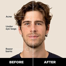 Stryx Corrector Barra Hombres Color Coñac Claro Pigmentos Naturales Que Ocultan Imperfecciones Acné Quemaduras Por Afeitado