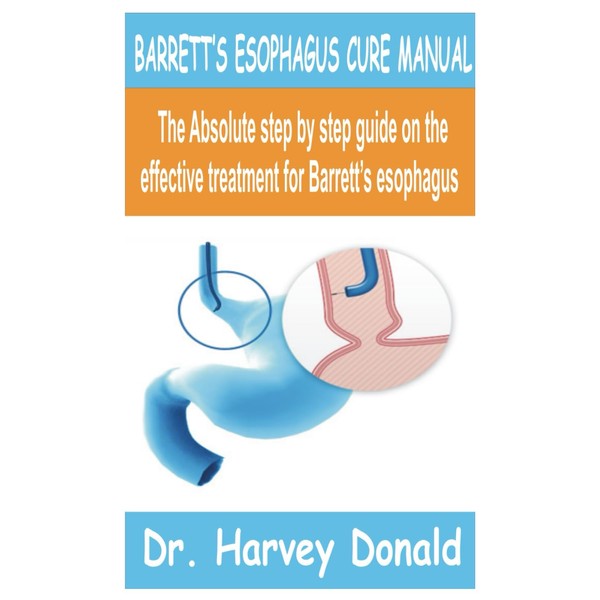 BARRETT’S ESOPHAGUS CURE MANUAL: The Absolute Step by step guide