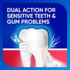 Sensodyne Sensitivity & Gum Fluoride Toothpaste, 75ml