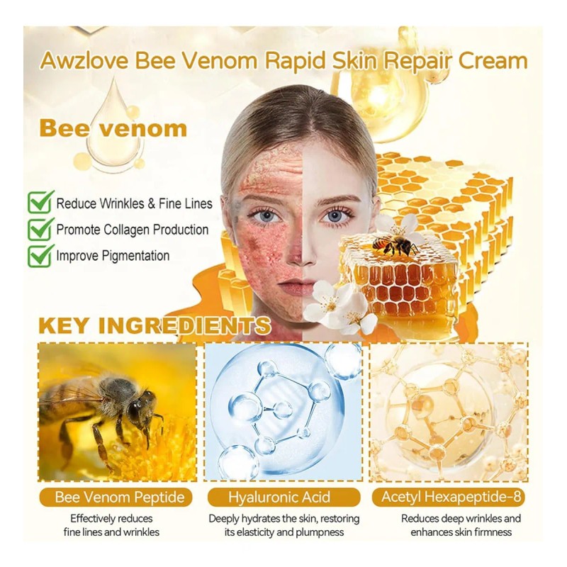 Mzhl Crema Awzlove For Reducir Las Imperfecciones De La