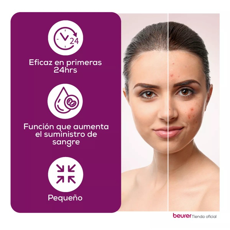 Beurer Limpiador De Poros Electrónico Luz Uv Fce75 Beurer