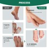 7 Days Ginger Foot Spray - Odor Control & Callus