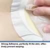 20PCS Ostomy Barrier Strips Y Shaped Adhesive Prevent Warping Edge