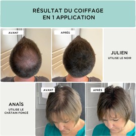 ULTI Paris Scattered Hair for Hair Thickening & Full Hair, 100% Natural! Pouring Hair for Hair Loss and Light Hair, Hair Powder, 27 g (Dark Grey) (27 g, Dark Grey)