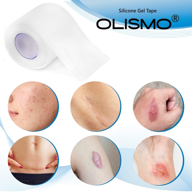 手術後 帝王切開 傷あ 米国式デザインテスト シリコーンゲルテープ ４センチ×150 センチ, ４センチ×300 センチ (４センチ×300センチ)