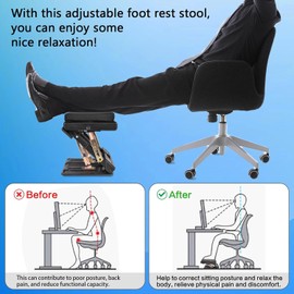 Scalebeard Foot Rest for Under Desk at Work 4-Level Height Adjustable,Ergonomic Foldable Footrest with Replaceable and Washable Cover for Office, Gaming,Computer, Soft & Removable Pad Desk Foot Stool