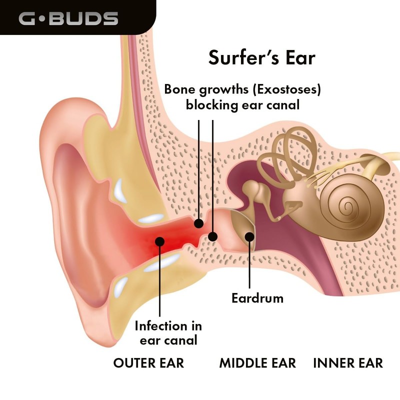 G.Buds Clear Surf Ear Plugs. Sound in Water Out. Perfect