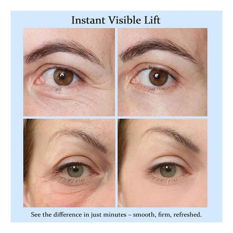Crema Tensora Para Las Bolsas Debajo De Los Ojos, Crema