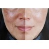 Zozu Serum Vitamina C Anti Manchas Paño Pechas Quemado Del