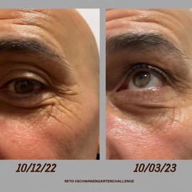 Schwanengarten Antioxidant Eye Cream / 슈바넨가르텐 안티옥시던트 아이크림