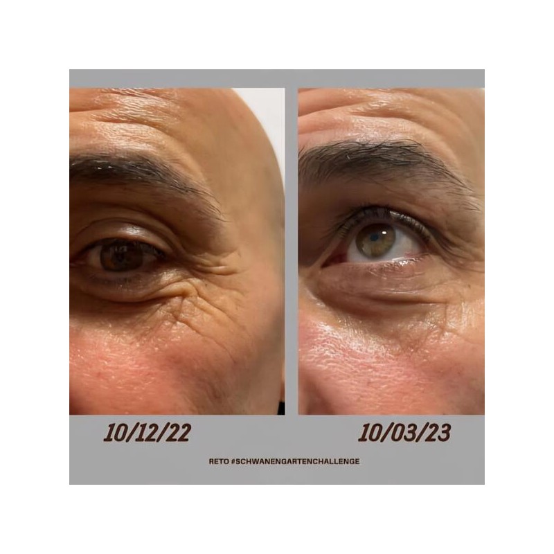 Schwanengarten Antioxidant Eye Cream / 슈바넨가르텐 안티옥시던트 아이크림