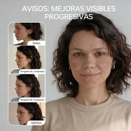 QUARXERY Exfoliante Espumoso Corporal y Facial con Ácido Mandélico y Lactobiónico Crema Exfoliante Suave para Puntos Negros, Acné, Axilas e Ingle Oscura, Limpieza de Poros con Sal Marina