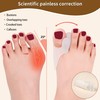 Bunion Cushion Protector and Big Toe Separator FOYOLO 8 Pack