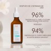 Moroccanoil Tratamiento Cuero Cabelludo Graso, 45 ml