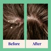The Powder Shampoo - Powder Shampoo Aluminum Bottle Exfoliating &