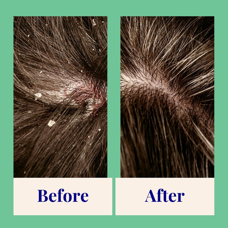 The Powder Shampoo - Powder Shampoo Aluminum Bottle Exfoliating &
