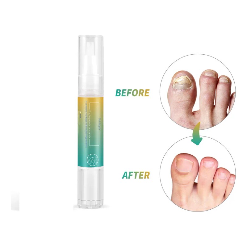 Limpiador Líquido Reparador Para El Cuidado De Las Uñas, 5