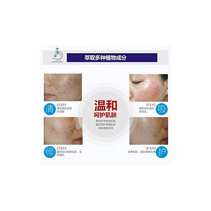 Bioaqua Crema Pure Skin Elimina Acné y Cicatrices Control De