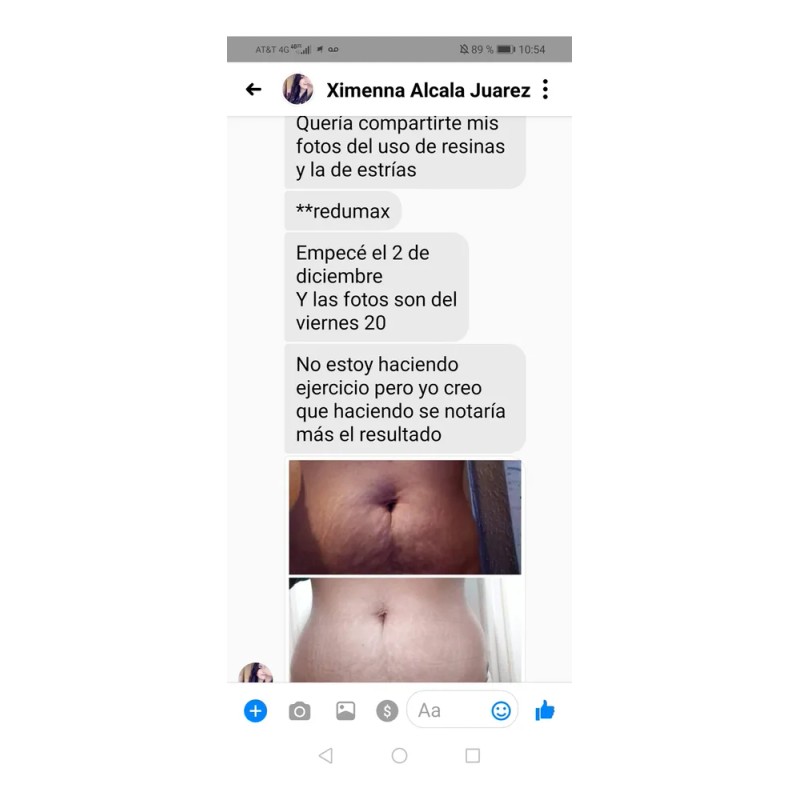 Gel Reductor Abdomen Potente Quema Grasa Mentol Eucalipto Eucalipto