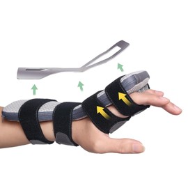 Radial Nerve Palsy Splint for Wrist Drop, Adjustable Static Fingers Fixation Brace, for Crutch Palsy, Limp Finger, Mcp Arthroplasty, Stroke Hand Recovery - Fits Right & Left Hand