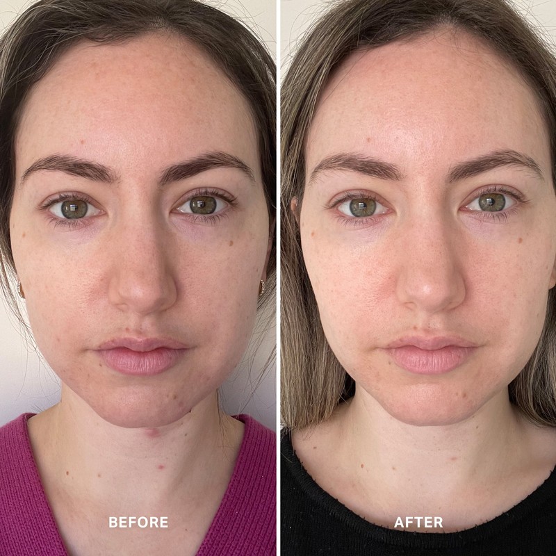 Alpha-H Vitamin B with 0.5% Niacinamide 25ml