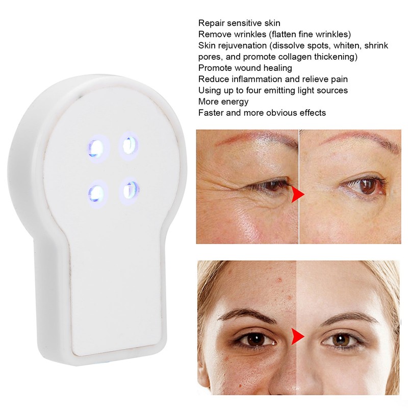 USB Plug In Mini Handheld Acne Removal Machine Blue Light