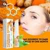 Lumibalm for Under Eye Bags, Turmeric Retinol Eye Cream Stick,