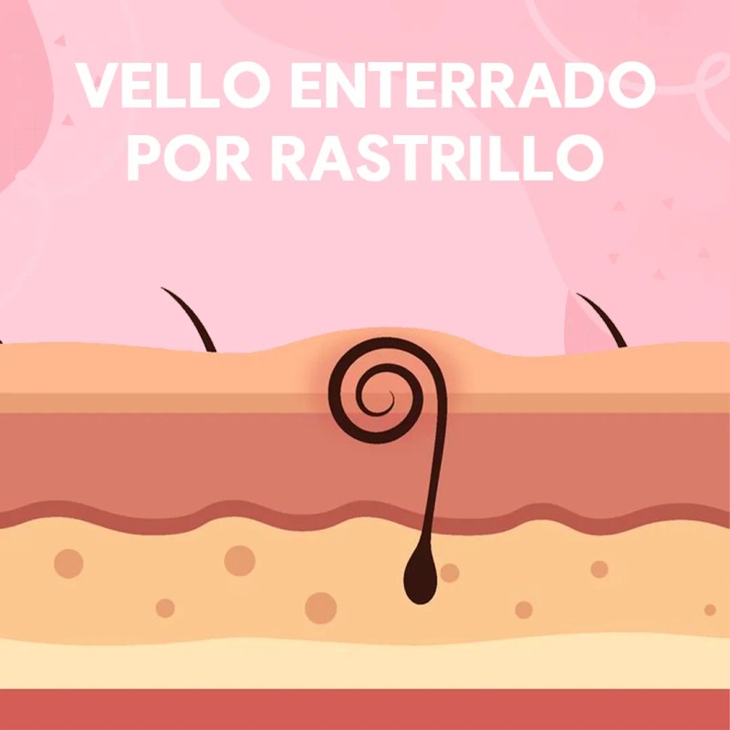 Kit De Tarro De Cera Española Con Refill 1minpretty