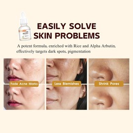 Hydrating Serum for Moisturize Skin, Reduces Skin Dullness and Dark Spots, 68% Rice Bran Water, 2% Alpha-Arbutin, Hydrating Facial Soothing Serum 30ML