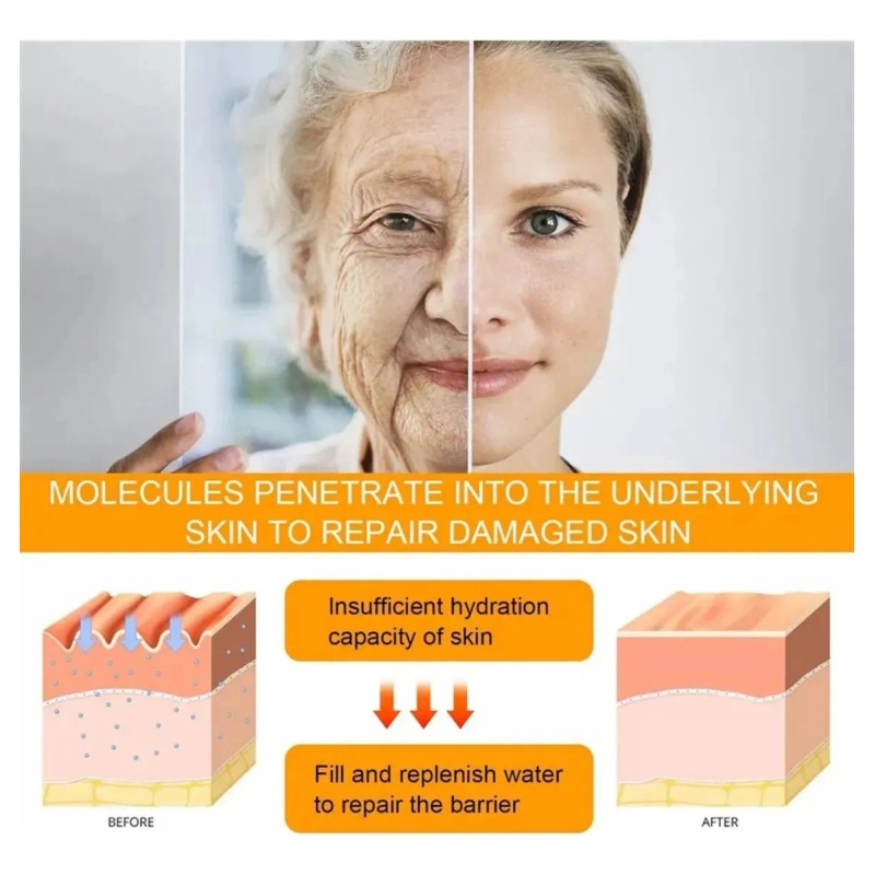 Crema Reafirmante Para Ojos, Elimina Bolsas Y Ojeras