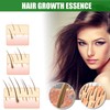 30ml 4PCS Ginger Hair Growth Spray Nutritious Moisturizing Hair Root