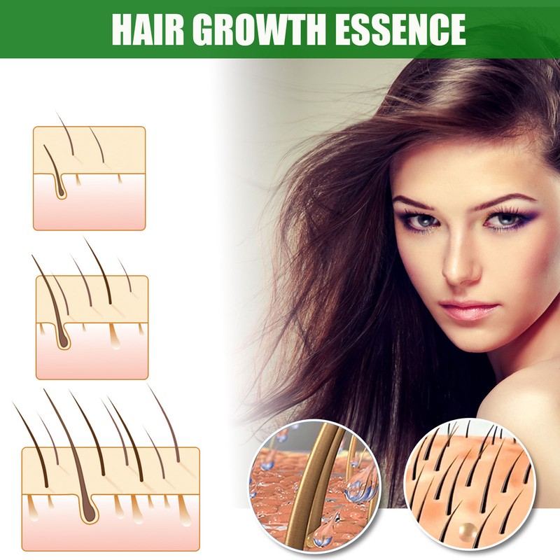 30ml 4PCS Ginger Hair Growth Spray Nutritious Moisturizing Hair Root