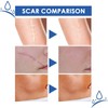 Professional Scar Removal Gel – Medical-Grade Treatment for Keloids, Surgery,