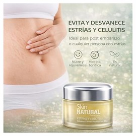 Bálsamo-Crema Anti Estrías Y Celulitis - Concentrado Regenerador Intenso - Previene y Atenua - Ideal para Embarazadas, Deportistas, Adolescentes y Die