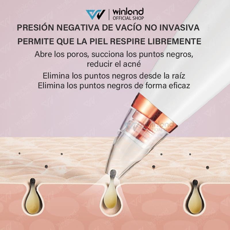 Winland Aspirador de puntos negros eléctrico, herramienta limpiadora de puntos