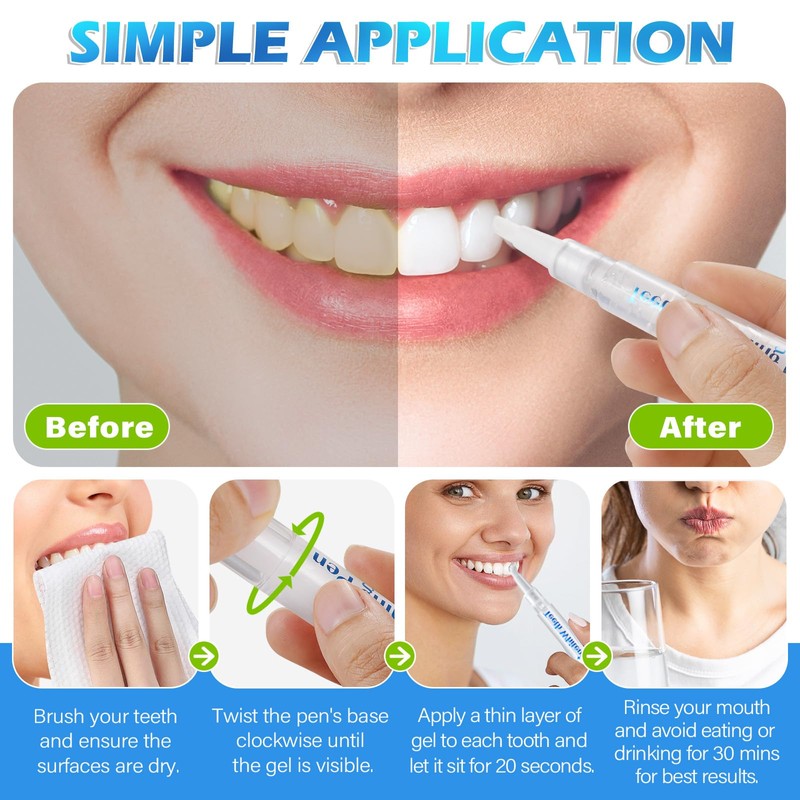 Smddx Smddx 4pcs Teeth Whitening Pen,Teeth Whitening Gel Essence-Fast-Acting Stain