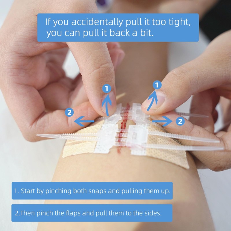 Emergency Wound Closure Strips, Butterfly Band-Aids