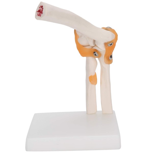 Modelo de Articulación del Codo, Modelo de Articulación del Codo,