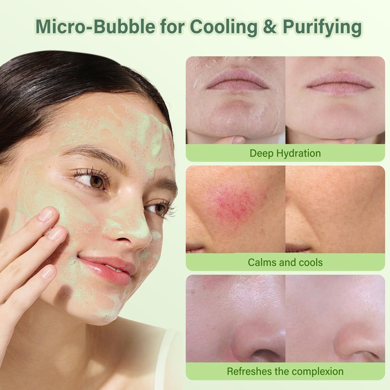 SPRINGSKY Aloe Vera Gel Mousse Bubble Facial Mask For Women