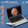 1080P HD Otoscope with 1.21'' Screen, Cleaner Camera for Family