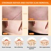 Silicone Scar Sheets (1.6"x 79" Roll-2M), Reusable Scar Silicone Strips