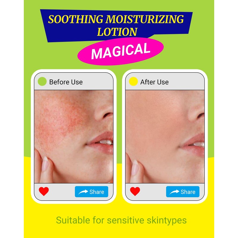 larosanna Soothing Moisturizing Lotion for Sensitive Skin Made in Australia,Skin