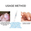 Fungus Nail Repair Pen Toenails, Nail Biological Repair Pencil, Repairs