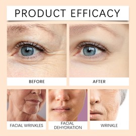 Eazerom 10 Hyaluron Serum,30ml Gesichtspflege Männer und Frauen,Hyaluronsäure serum für das Gesicht mit Anti-Falten-Wirkstoffen,Hyaluronsäure Gesichtsserum, Feuchtigkeitsspendendes Serum