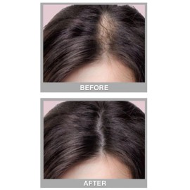 Cover Your Gray Fill-In Powder Hair Color w/ Procapil - Medium Brown (Pack of 2)