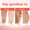 Foot Peel Mask (3 Pairs) - Foot Mask for Baby