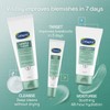 Cetaphil Gentle Clear Clarifying Blemish Cleanser 124ml, Face Wash for