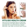Vitíligo Aceite White Vitíligo Para 4×crema T
