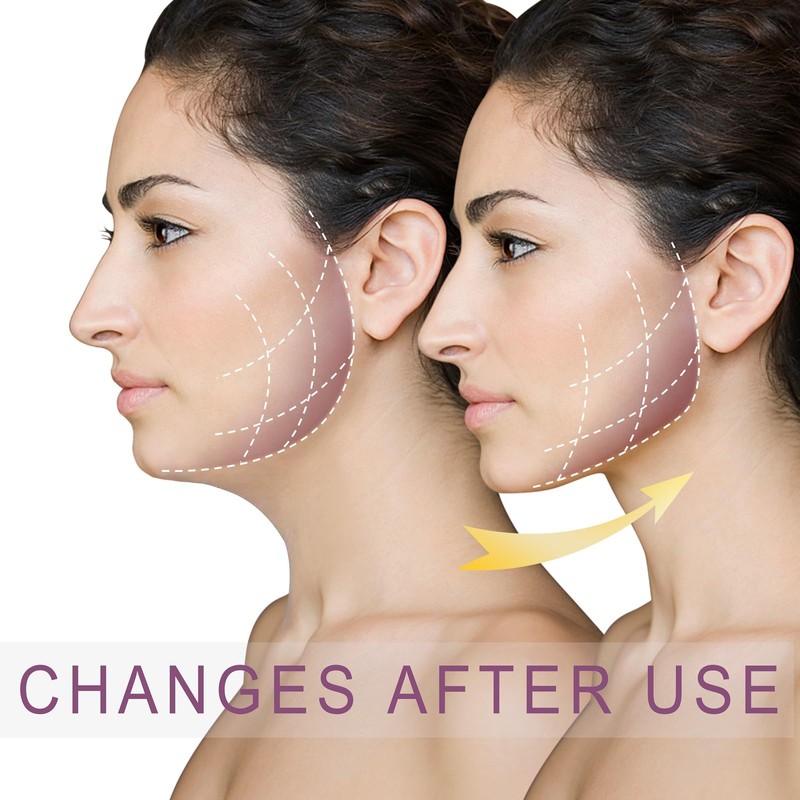 V Line Lifting Mask Chin Strap for sleeping jawline Shaped