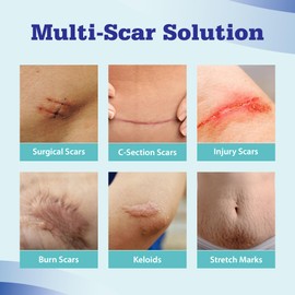 Aroamas Scar Advanced Scar Gel - Medical-Grade Silicone Scar Gel for Surgical Scars, for Face, Scar gel with silicone for Keloids, C-Section, Cosmetic Procedures, Burns, Injuries - 45g